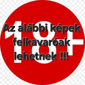 Újabb műtét vár ránk 1